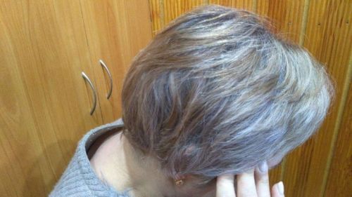 «Үтәр әле» түгел! Баш авырту бик күп төрле авыруларның билгесе булырга мөмкин