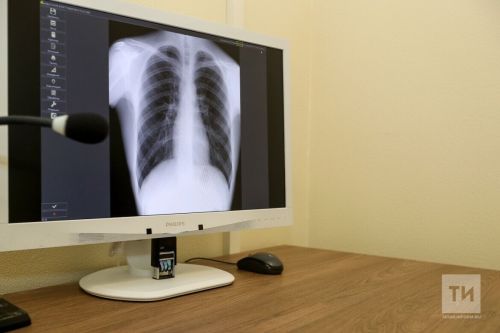 Татарстанда 13 яшьлек үсмер пневмониядән үлгән