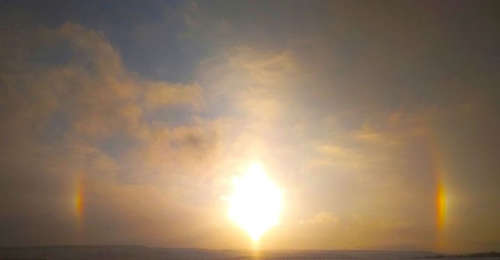 Татарстанның атказанган артисткасы яман шеш белән авырый